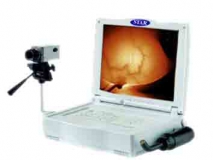 红外乳腺扫描仪M305892